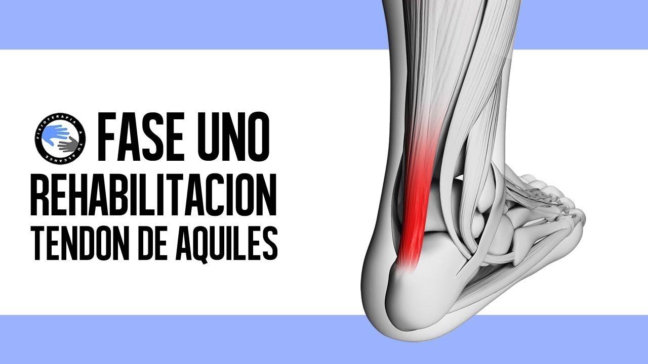 Rotura del tendon de aquiles, ejercicios y rehabilitacion postcirugia en la fase aguda