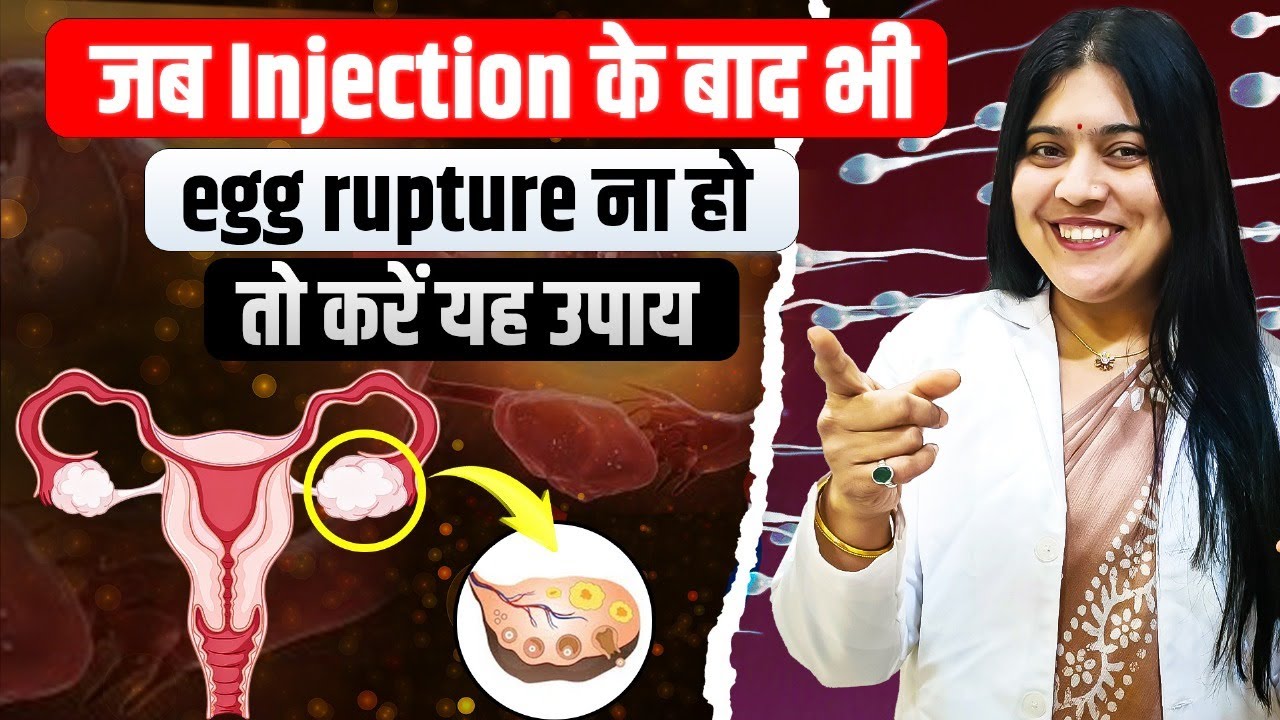 Injection लगवाने के बाद भी Egg Rupture नहीं?|जानें आयुर्वेदिक उपाय |Infertility Solution | Dr.Jyoti 