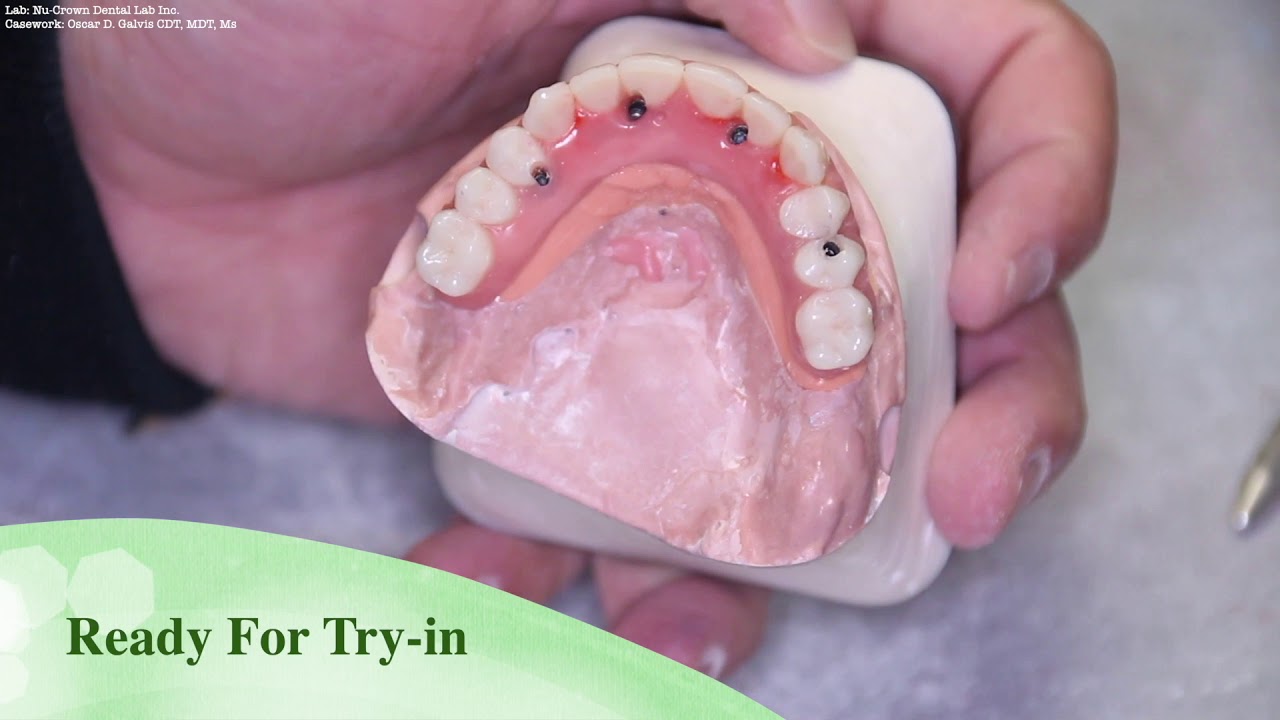 Trilor  Full Analog Full Fabrication Procedures