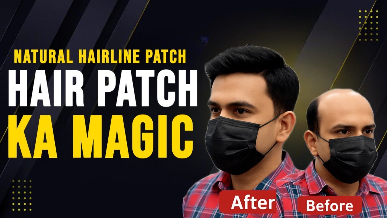 Baal Wapas Paayein 1 Ghante Mein | Rizy Hair Solution | Best Hair Patch Centre | 9599858612