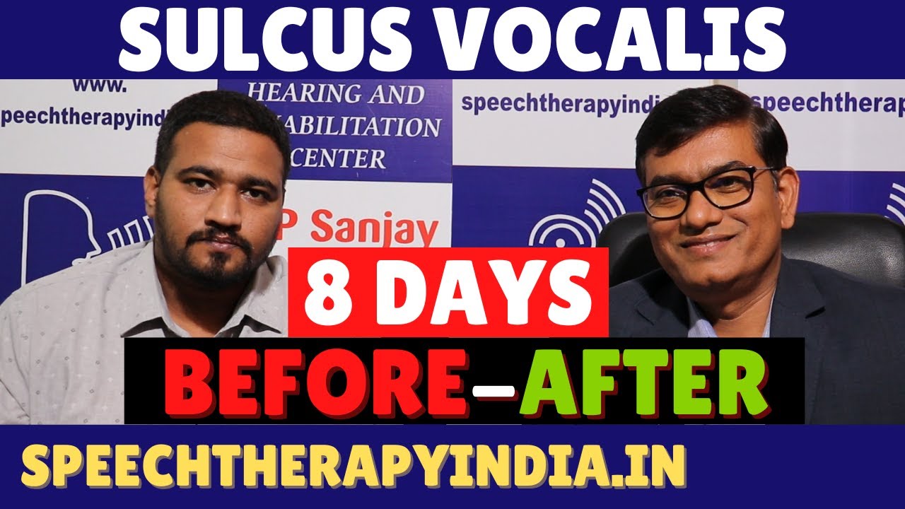 Before-After | Sulcus Vocalis | 8 Days Voice Therapy | By #slpsanjaykumar | Breathy Voice Treatment
