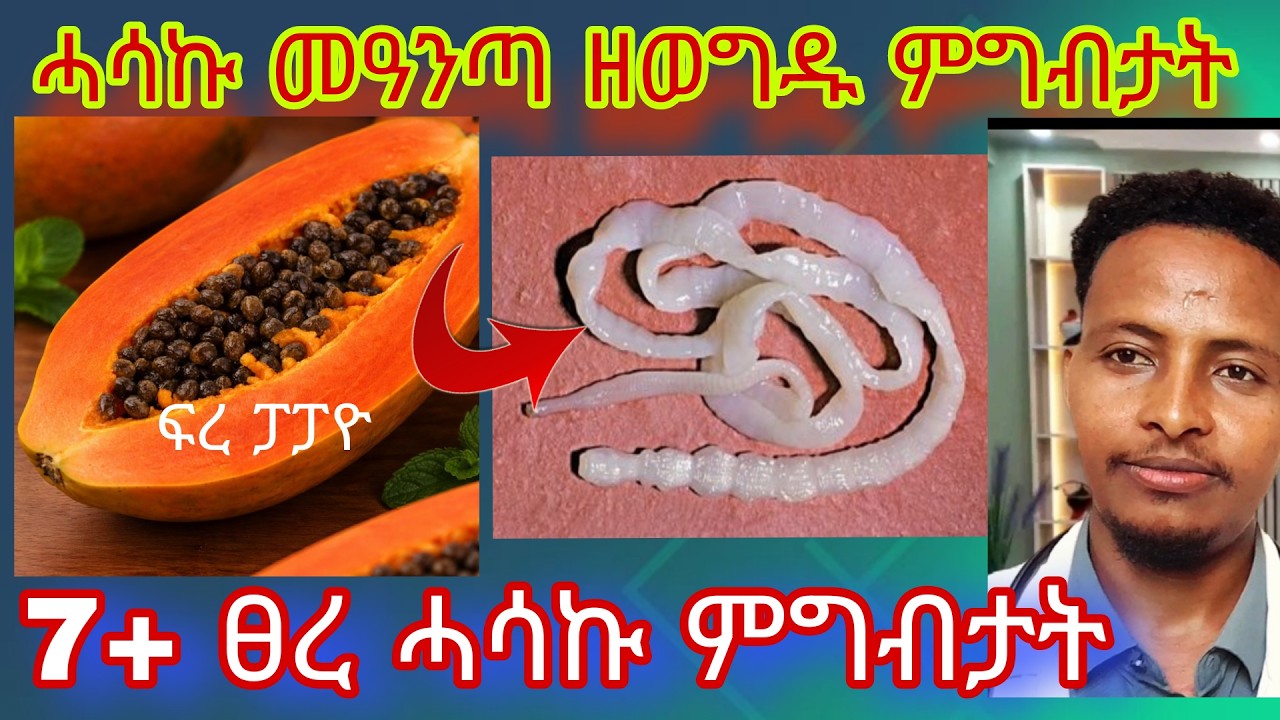 🔴7+ ብሉፃት ምግብታት፣ሓሰካ መዓንጣ ንምውጋድ ዝሕግዙ:ከየምልጥኩም/7 Powerful Foods That Kill Parasites Naturally/