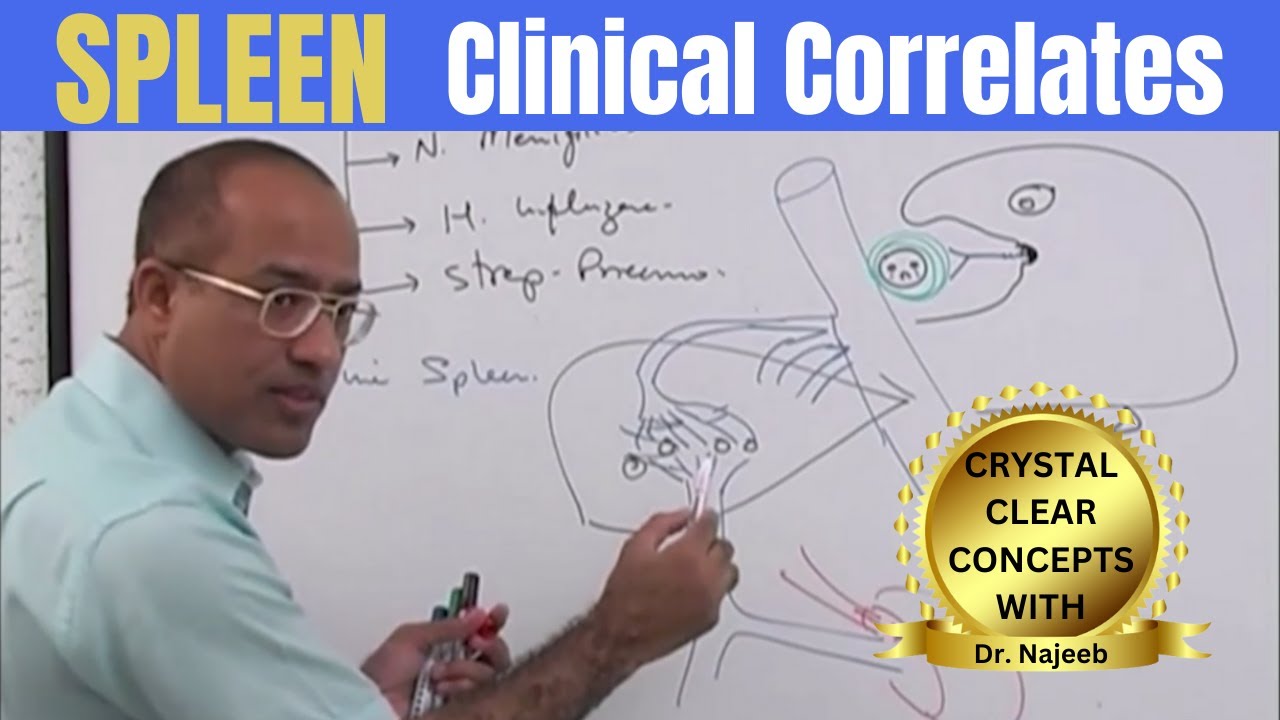 Spleen | Clinical Correlates👨‍⚕️