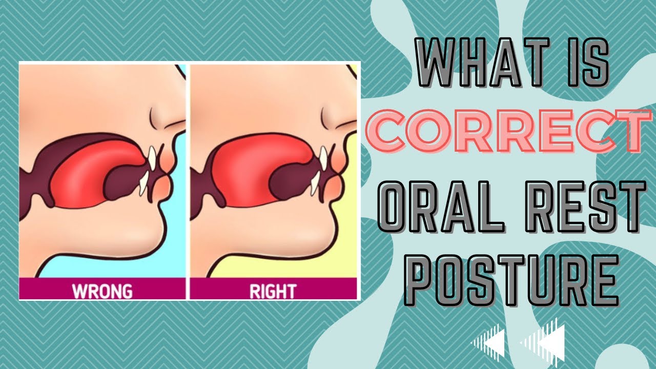 TMJ Issues? Do you know what correct oral rest posture is?