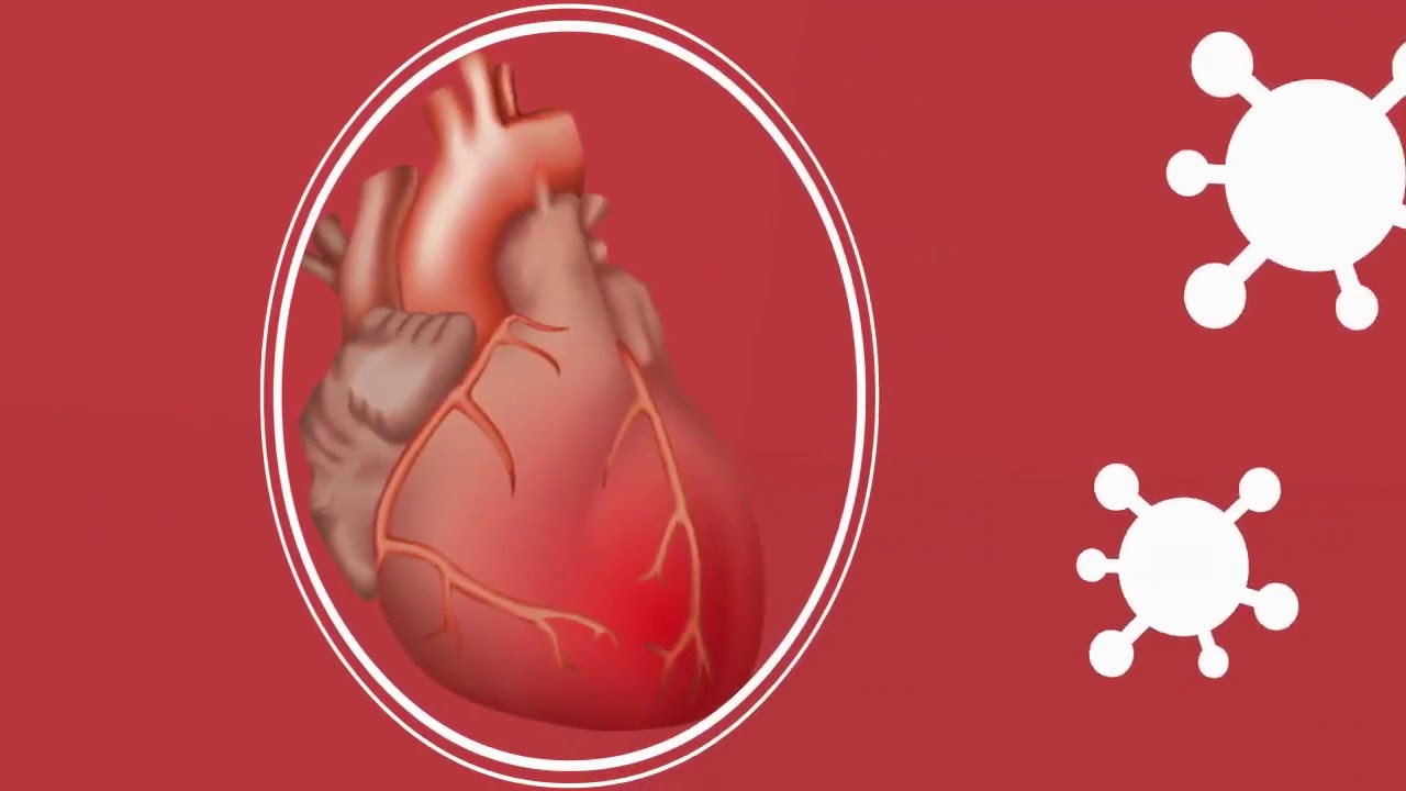 &iquest;Qu&eacute; es la Pericarditis?