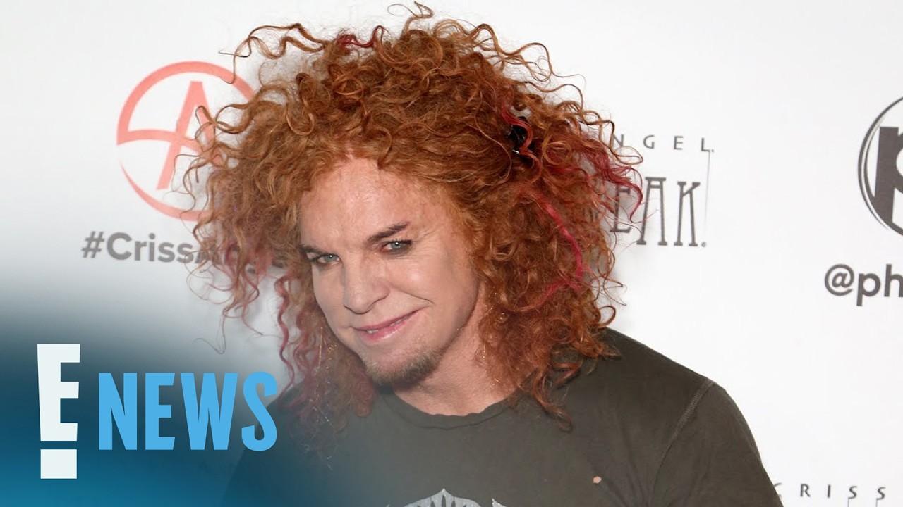 Комик Carrot Top проходит лечение после госпитализации в Лас-Вегасе