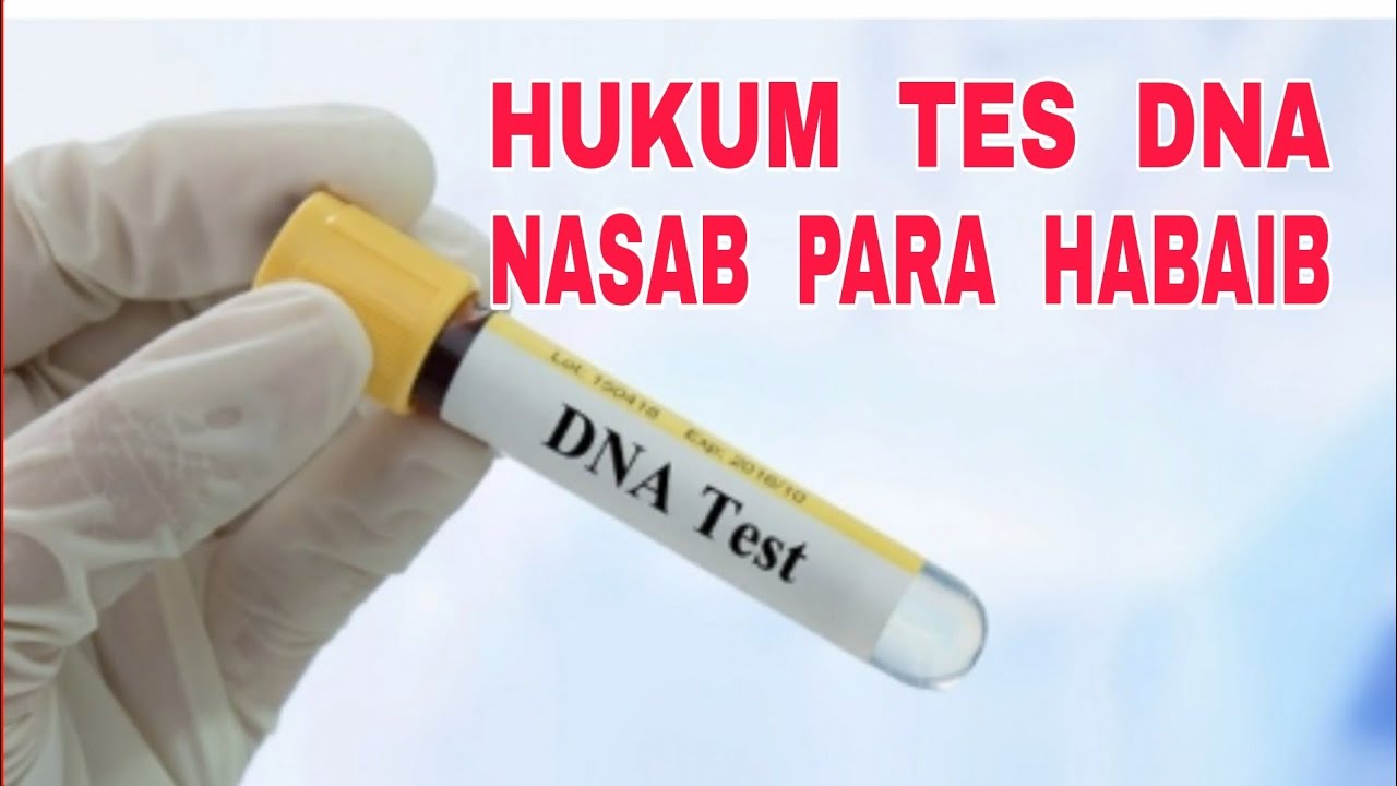 Hukum Tes DNA untuk Menentukan Nasab Para Habaib Dzurriyah Nabi ﷺ