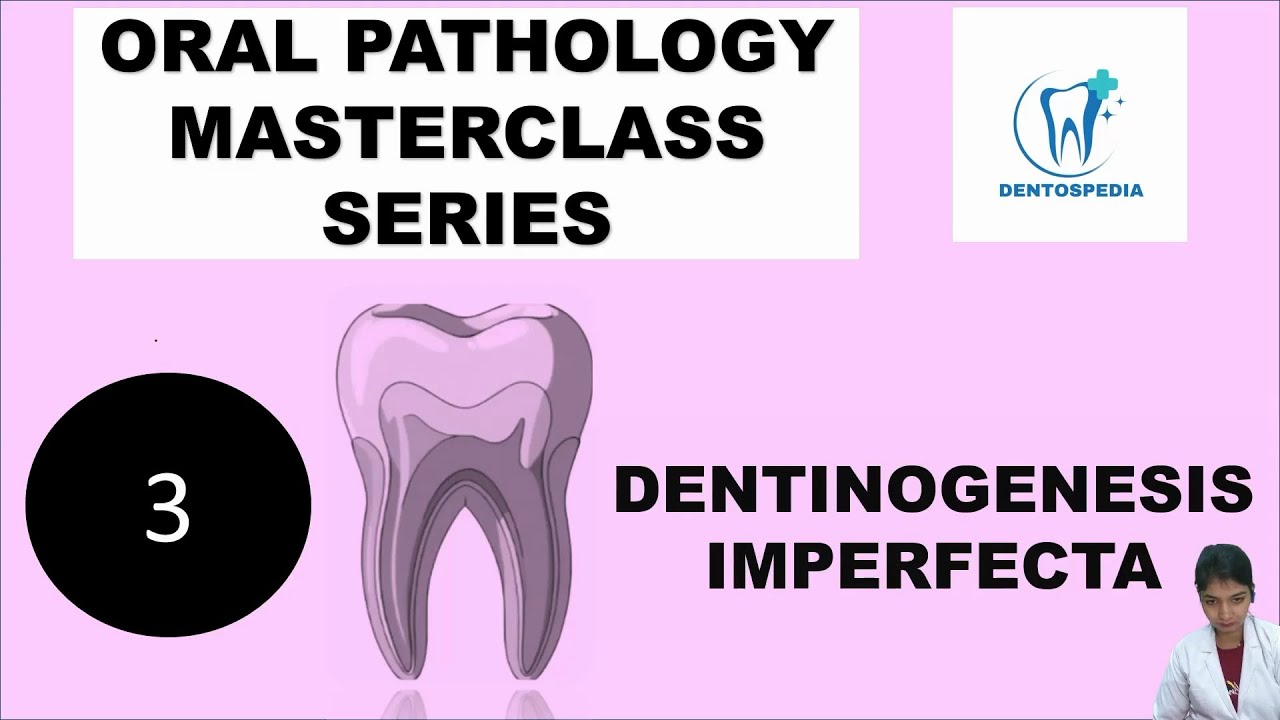 OP 3 Dentinogenesis Imperfecta Explained | Oral Pathology | #oralpatho #oralpathology  #afk #inbde