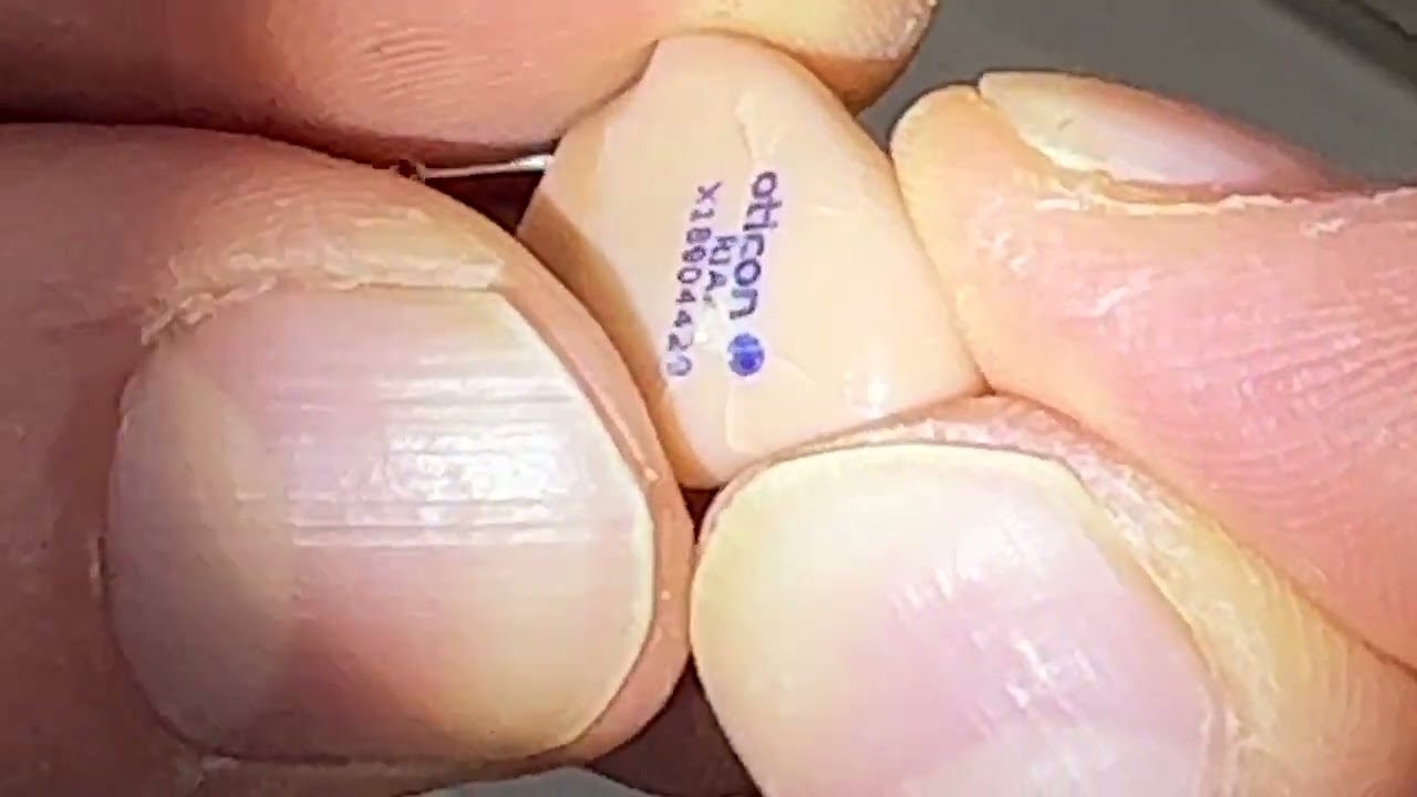 How to repair minor shell cracks for in-the-ear hearing aids