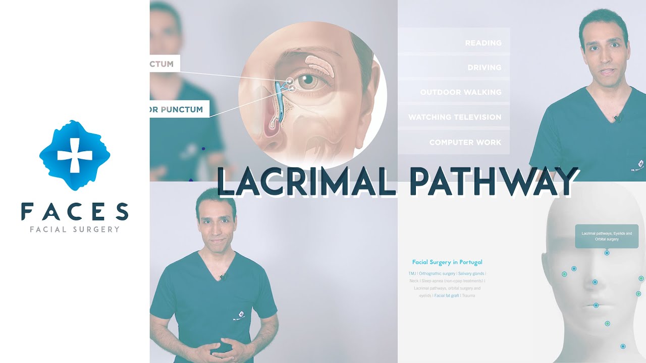Tears, watery eyes and lacrimal pathway infection