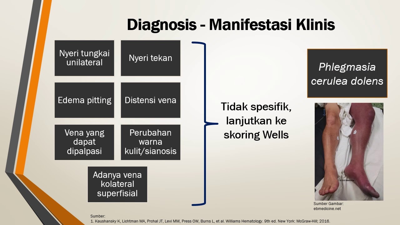 Trombosis Vena Dalam
