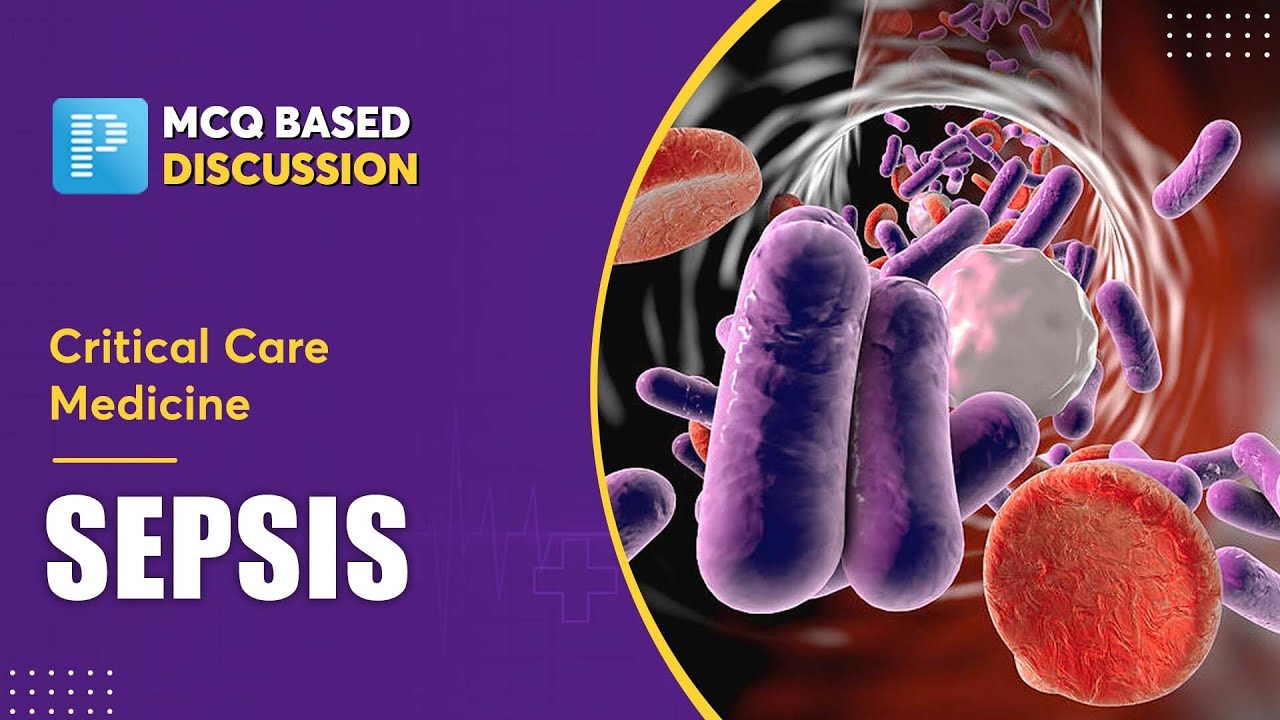 Critical Care Medicine - Sepsis [General Medicine] - NEET SS MCQ Discussion