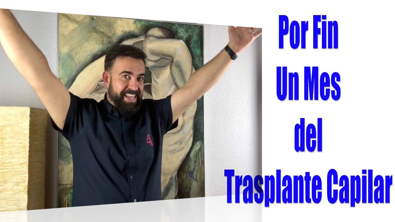 Un mes de Implante Capilar con Calvonuncamas [6 Tutorial]