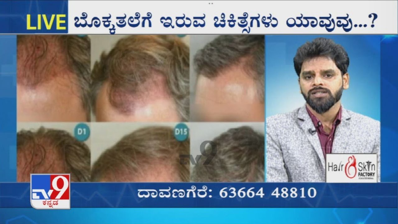 TV9 Nimma Doctor | Hair And Skin Factory | Hair Loss | Hair Fall Treatment | Hair Transplant