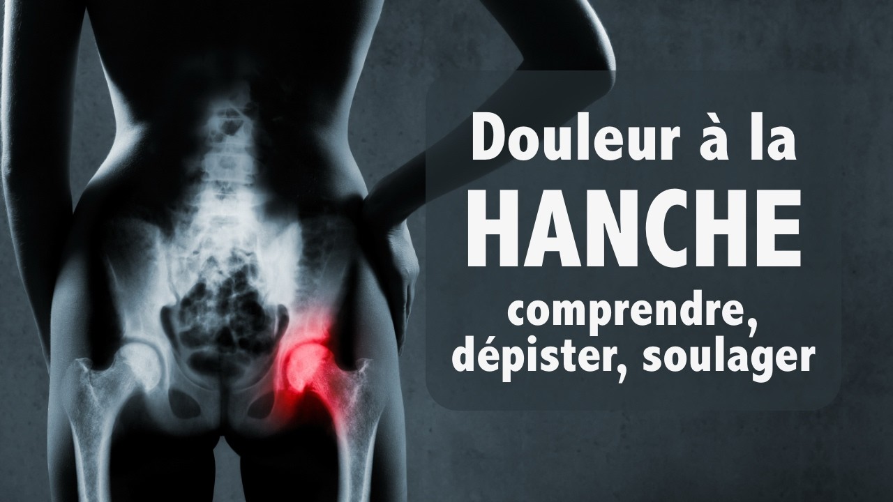 Douleur &agrave; la hanche: comprendre, d&eacute;pister, soulager (tout simplement)