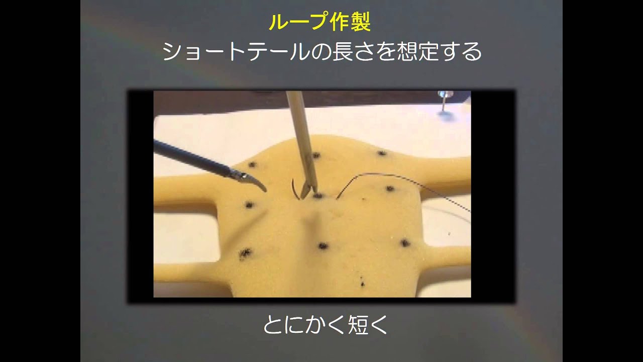 初級者から初心者へ伝える腹腔鏡での縫合結紮のTips