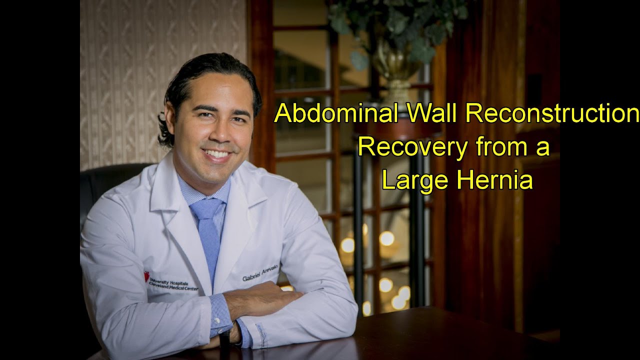 Recovery from Abdominal Hernia Surgery, Abdominal Wall Reconstruction, Large Hernia Follow-up