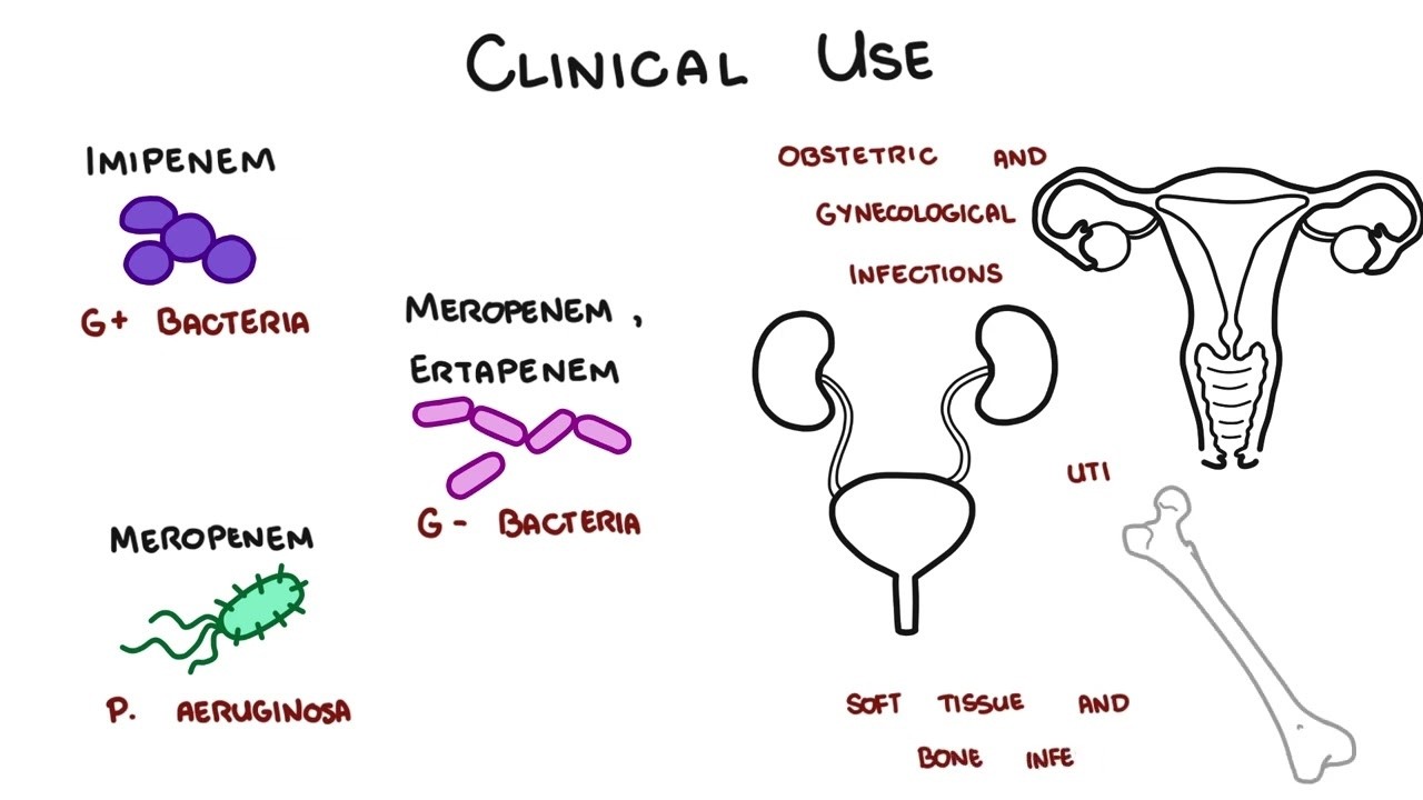 Carbapenem Antibiotics - Meropenem, Imipenem, Ertapenem