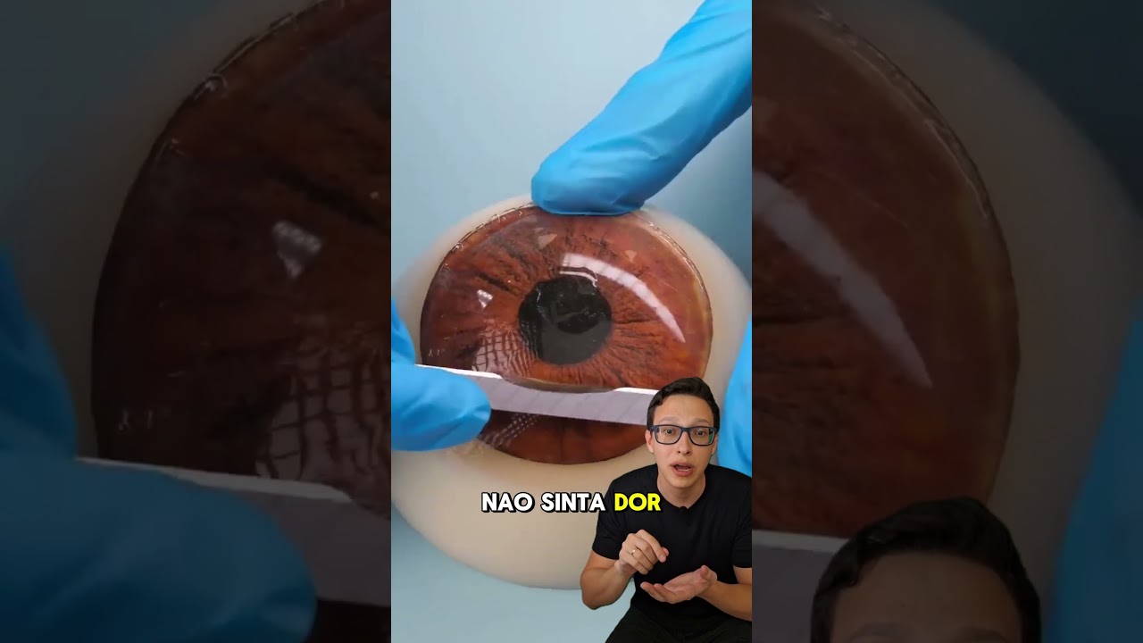 Corrigindo Miopia 👨&zwj;⚕️👓 #medicina #medico #oftalmologia #curiosidades #curiosidademedicina #saude