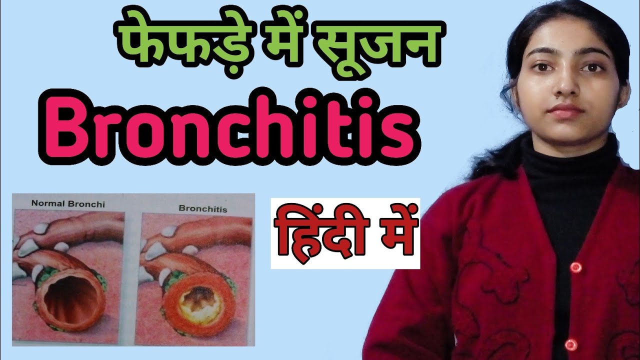 Bronchitis kya hai? |Types |Symptoms|Causes and risk factors|Treatment|Msn|