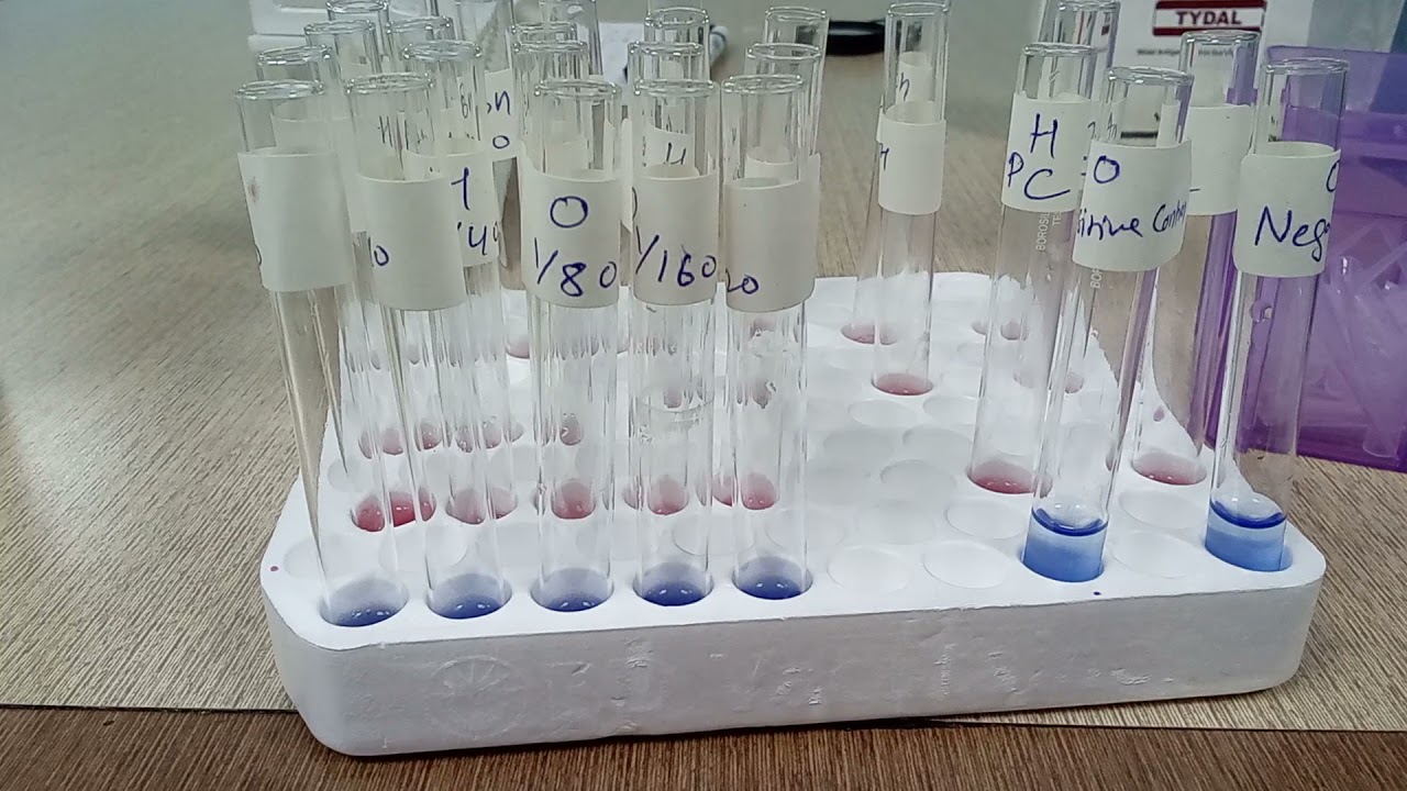 Widal Tube Method part 2