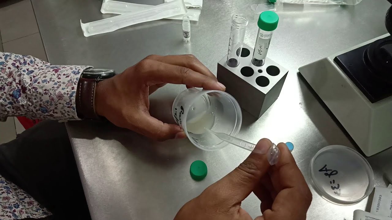 Double Density Gradient Procedure || IUI Sample || IVF Video||