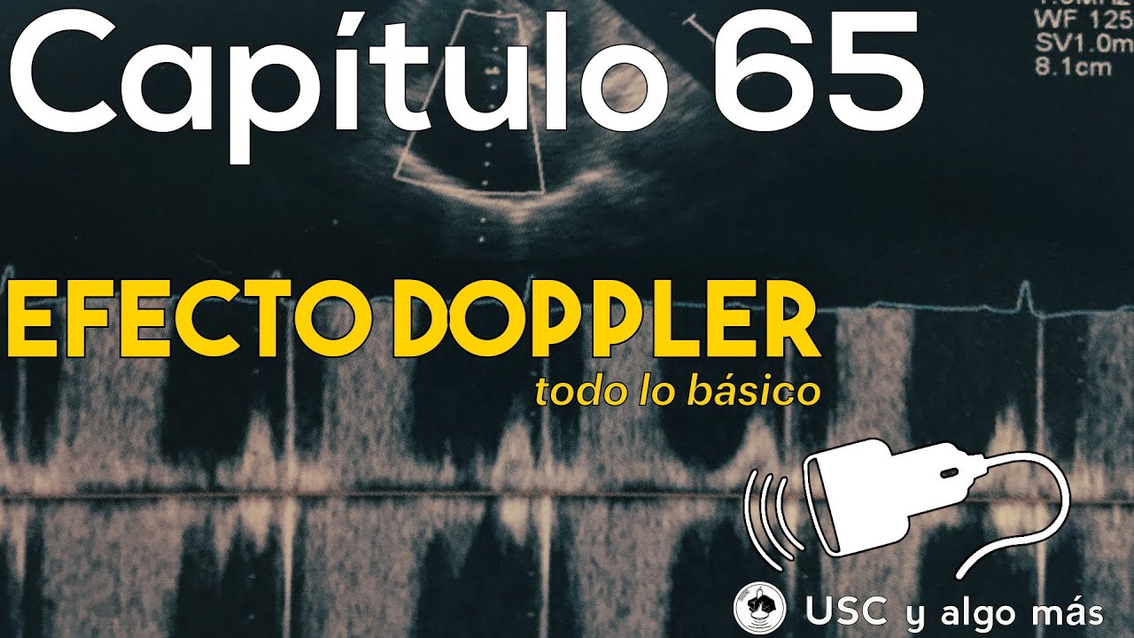 Capítulo 65: Efecto Doppler