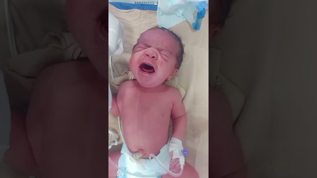 تعلم تشفيط إفرازات ل طفل حديثي الولاده 🙂 بطريقه احترافيه