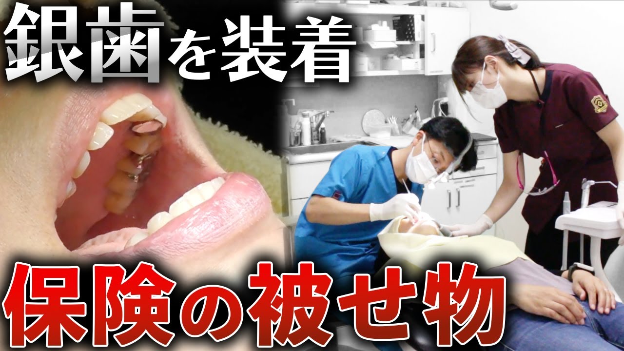 地域に寄り添う春日井市さくら歯科！歯が折れた患者様が治療に選んだ理由とは？
