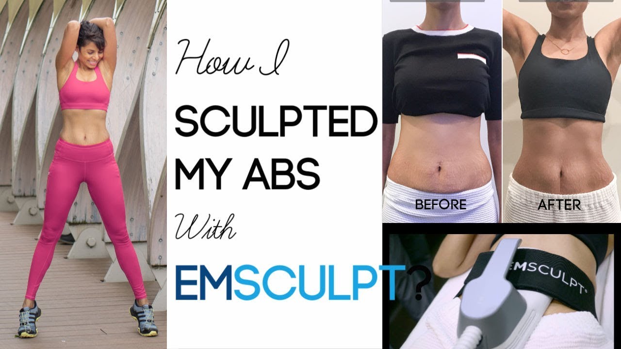 EMSCULPT EXPERIENCE/ Fastest Way to Build Muscle and Shred Fat Simultaneously/ GIVEAWAY