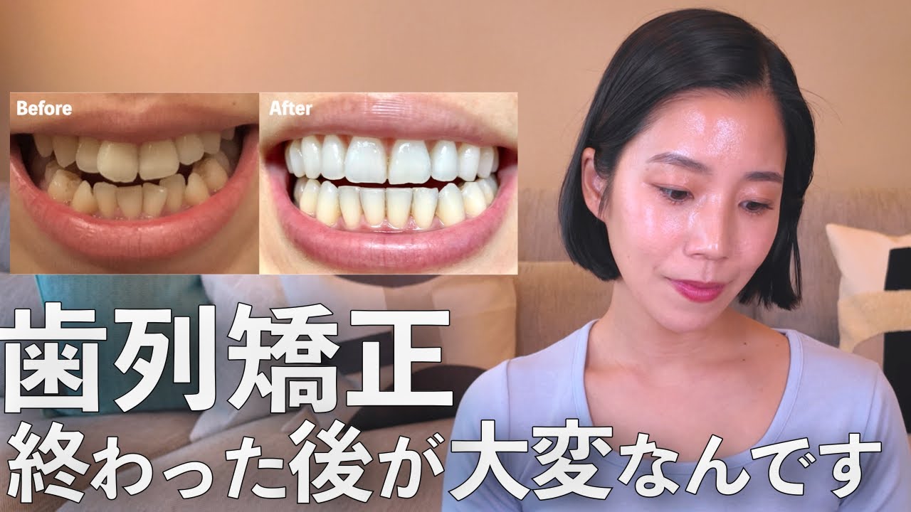 歯列矯正が終わったその後〜苦労してること３選
