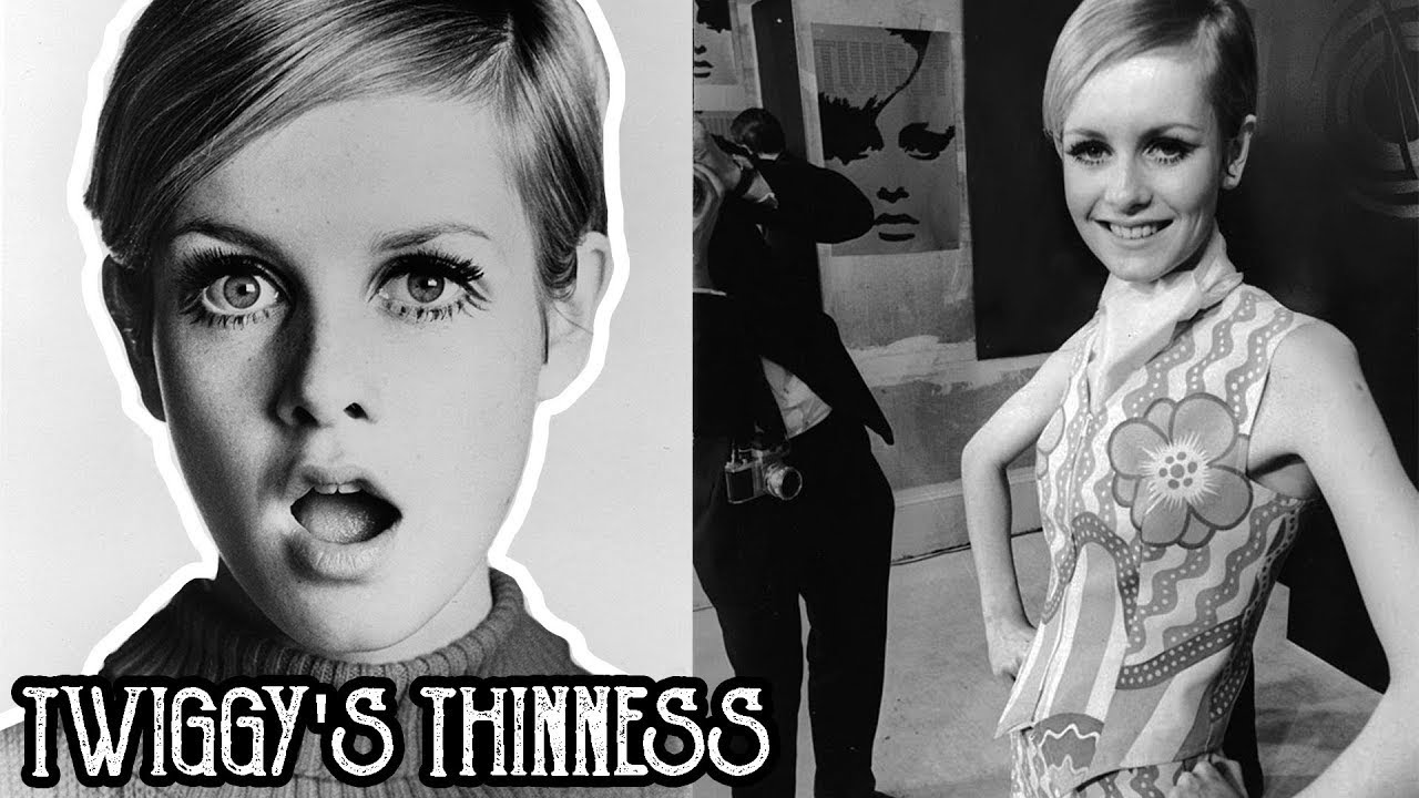 Is it Really Twiggy’s Fault That Thinness Became Fashionable?