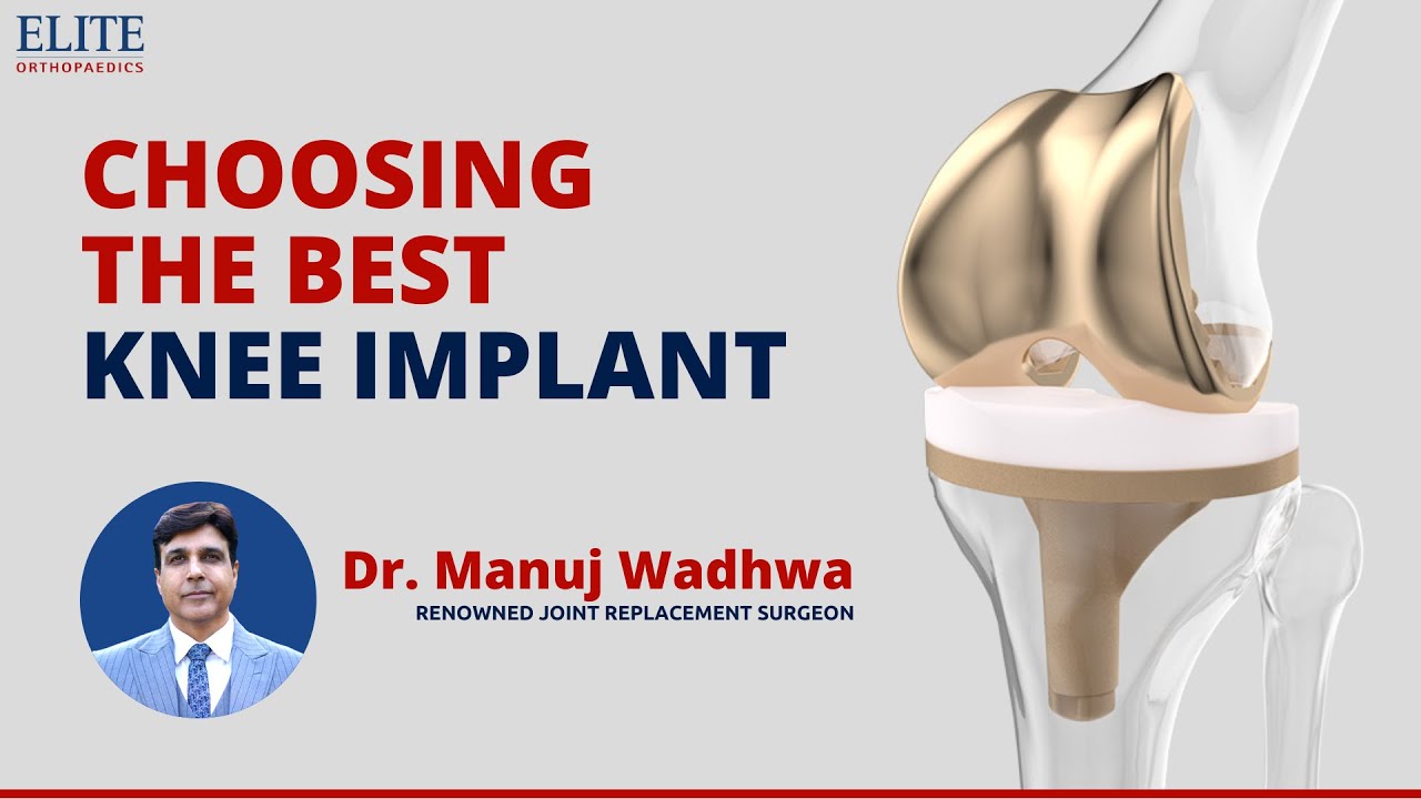 Choosing the Best Knee Implant - Dr.Manuj Wadhwa - Renowned Adult Joint Reconstruction Surgeon India