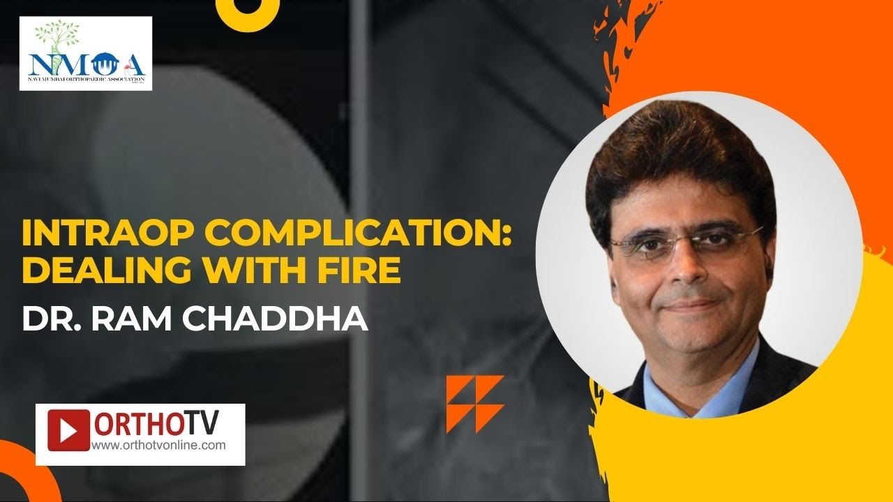 NMOACON 2022 : Intraop complication: dealing with fire - Dr. RAM CHADDHA
