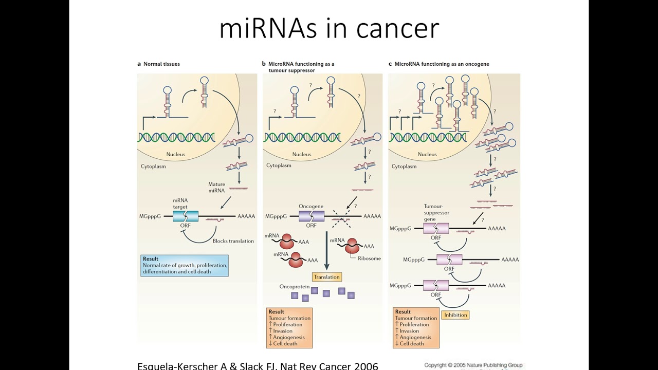 Investigating the role of microRNAs in pancreatic cancer progression
