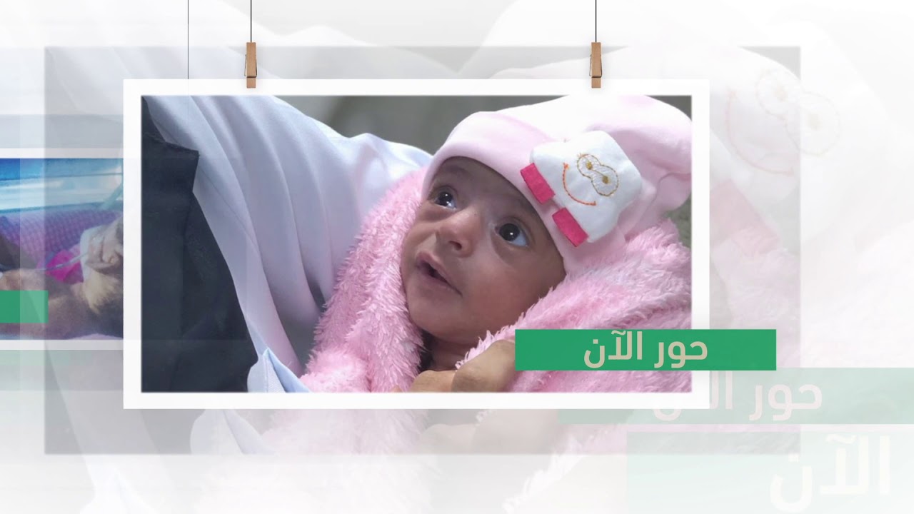 مستشفى الولادة والأطفال الجديد بحائل