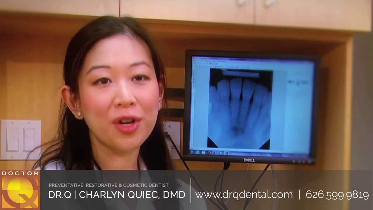 Dentist Video Marketing | Call 888-477-5376 | Green Gorilla Video