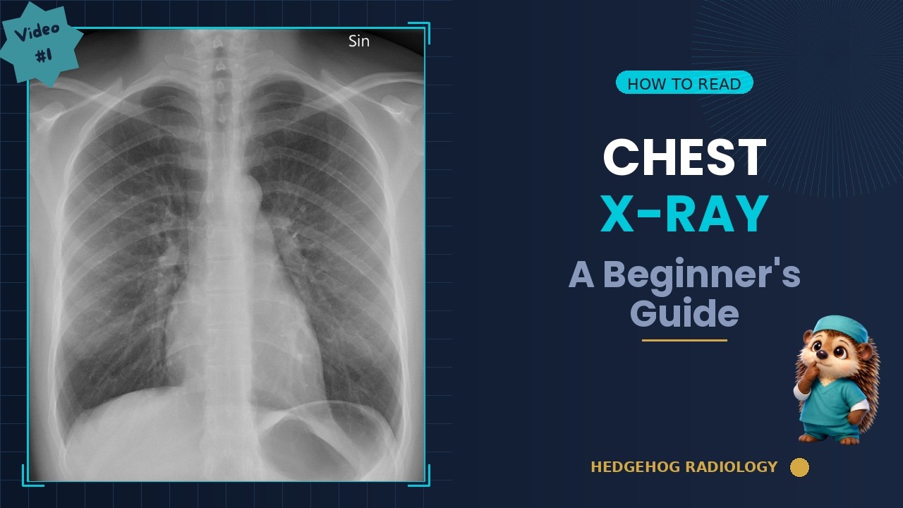 How to Read a Chest X-Ray — A Beginner's Guide