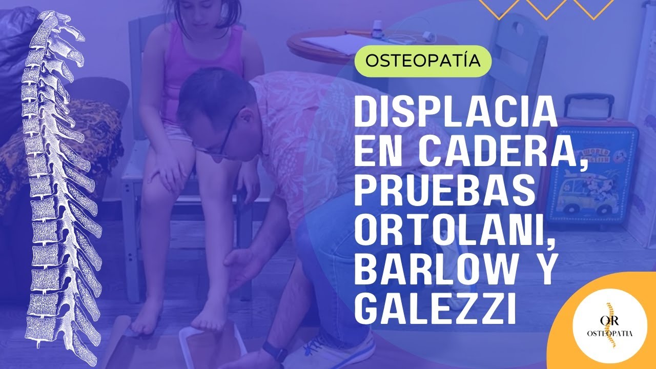 Displacia en cadera, pruebas Ortolani, Barlow y Galezzi