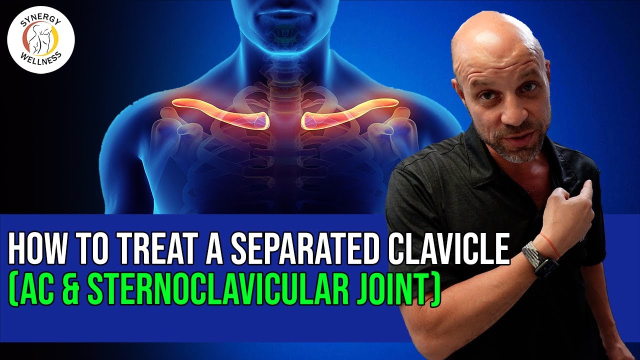 How To Treat A Separated Clavicle (AC & Sternoclavicular Joint)