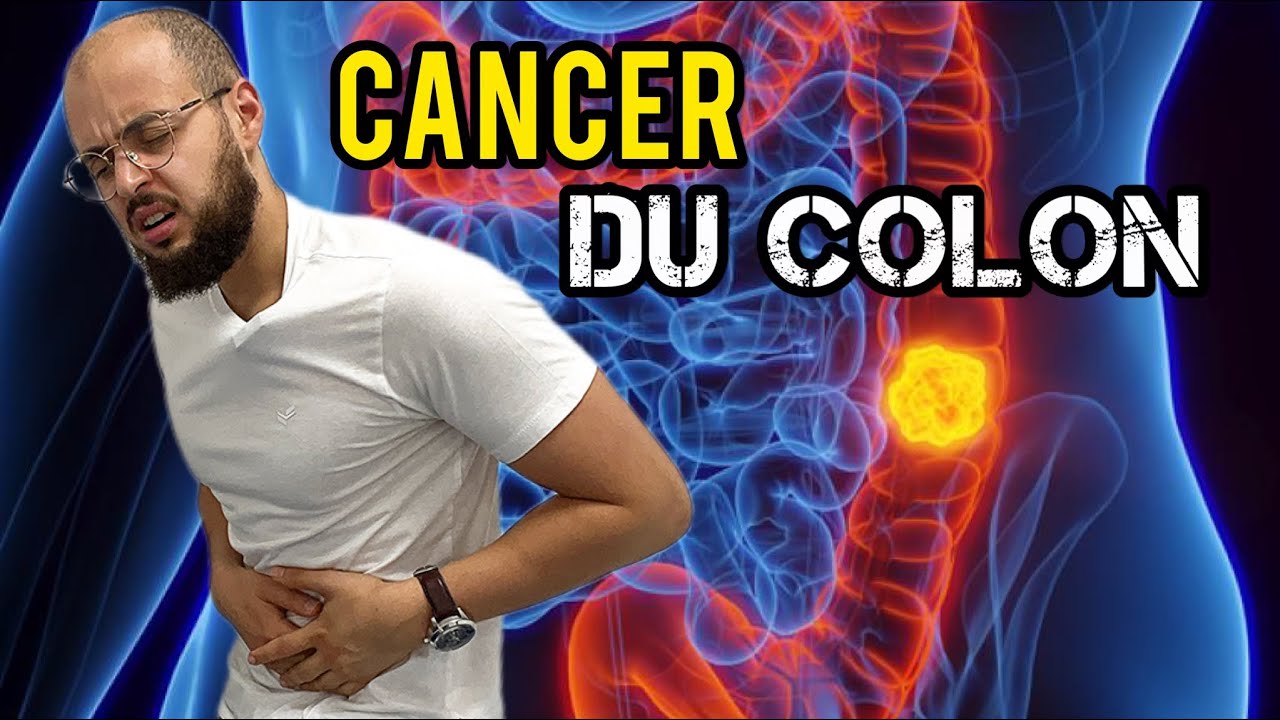 Les sympt&ocirc;mes du CANCER du COLON que vous ne devez pas ignorer !