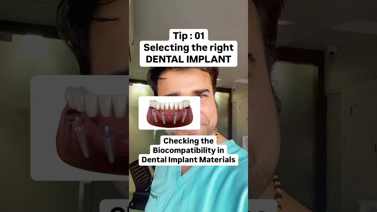 Biocompatibility of Dental Implants! 