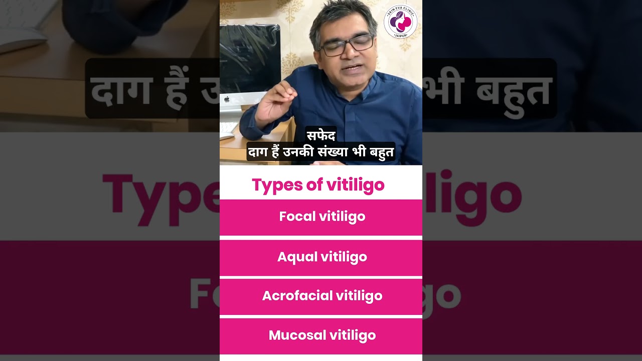 What Are the Different Types of Vitiligo? | Focal, Segmental & Vulgaris | Dr. Sunil Kothiwala