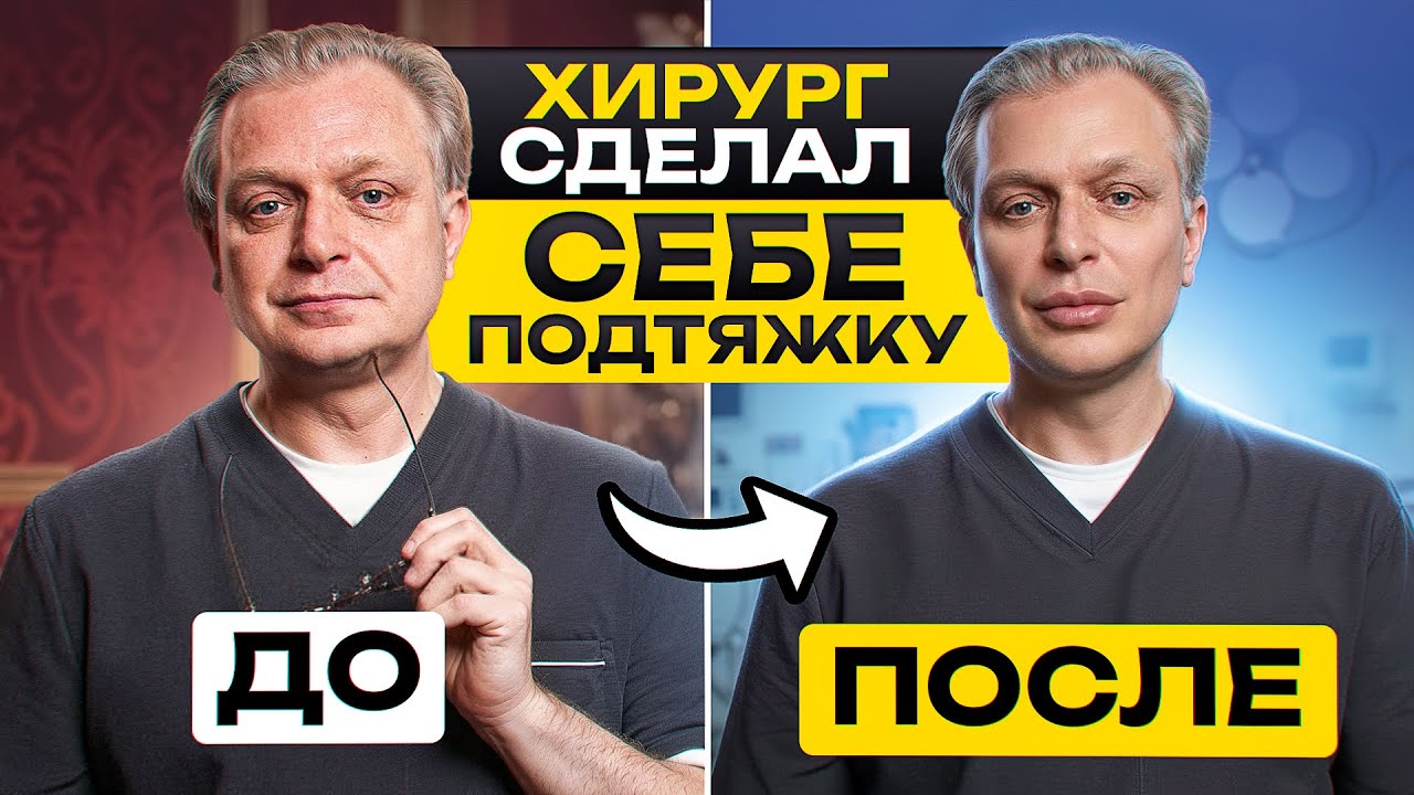 Хирург сам сделал себе подтяжку. Какие последствия? Убрал мешки под глазами?