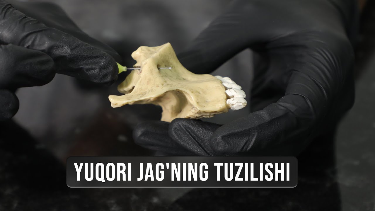 Yuqori jag' tuzilishi modelda