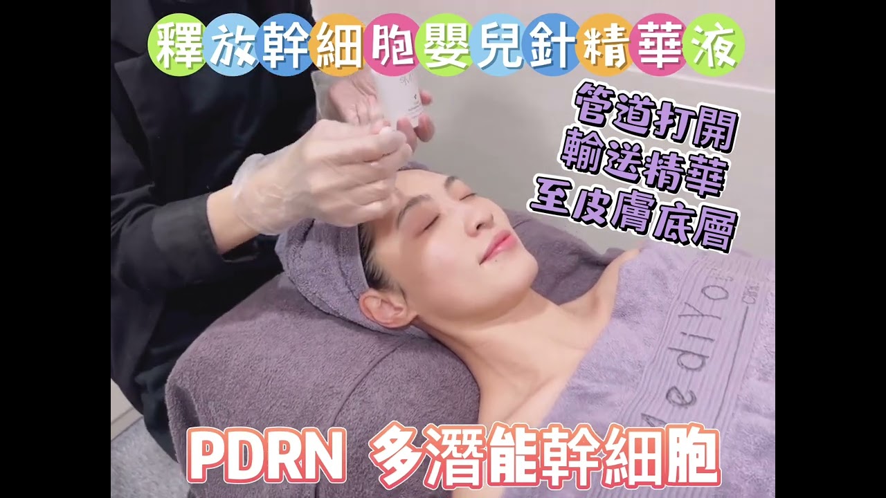 韓國sMTS 幹細胞嬰兒水晶針￼ Korea sMTS Stem Cell Needleless Soluble Microneedles Therapy Treatment