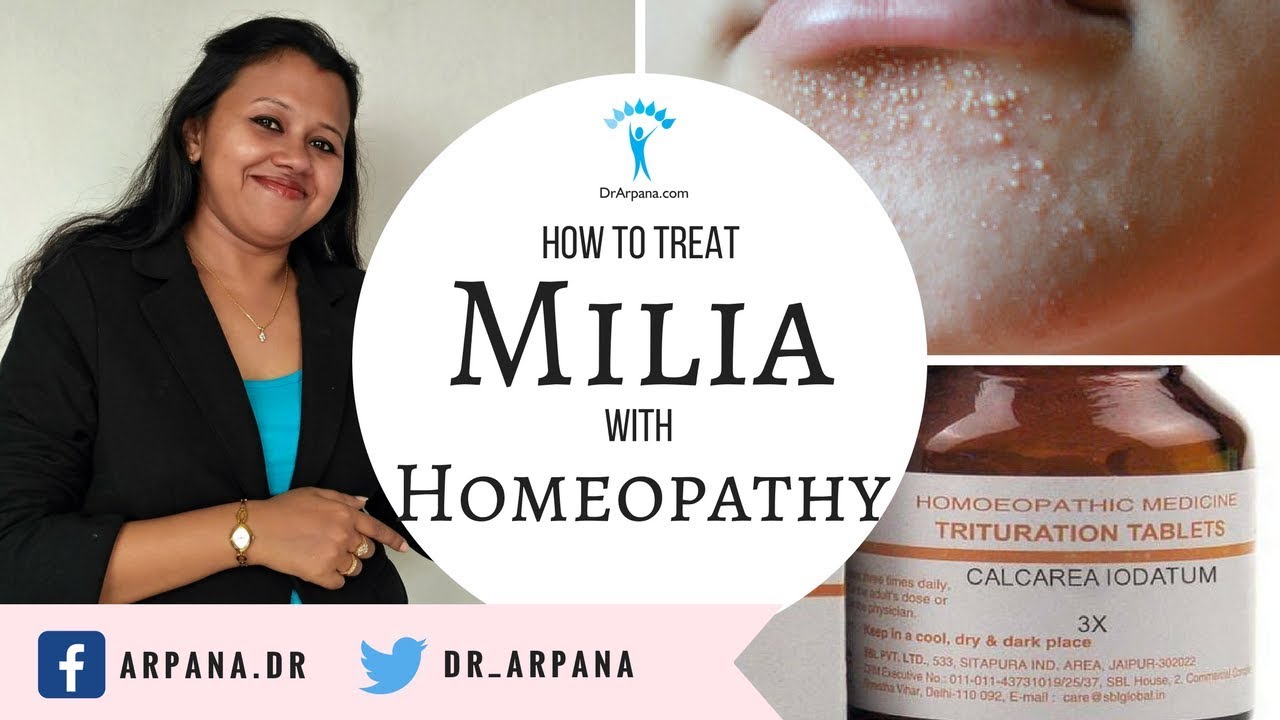 मिलिया क्या है व होम्योपैथिक इलाज || Homeopathic Medicine For MILIA Or Milium