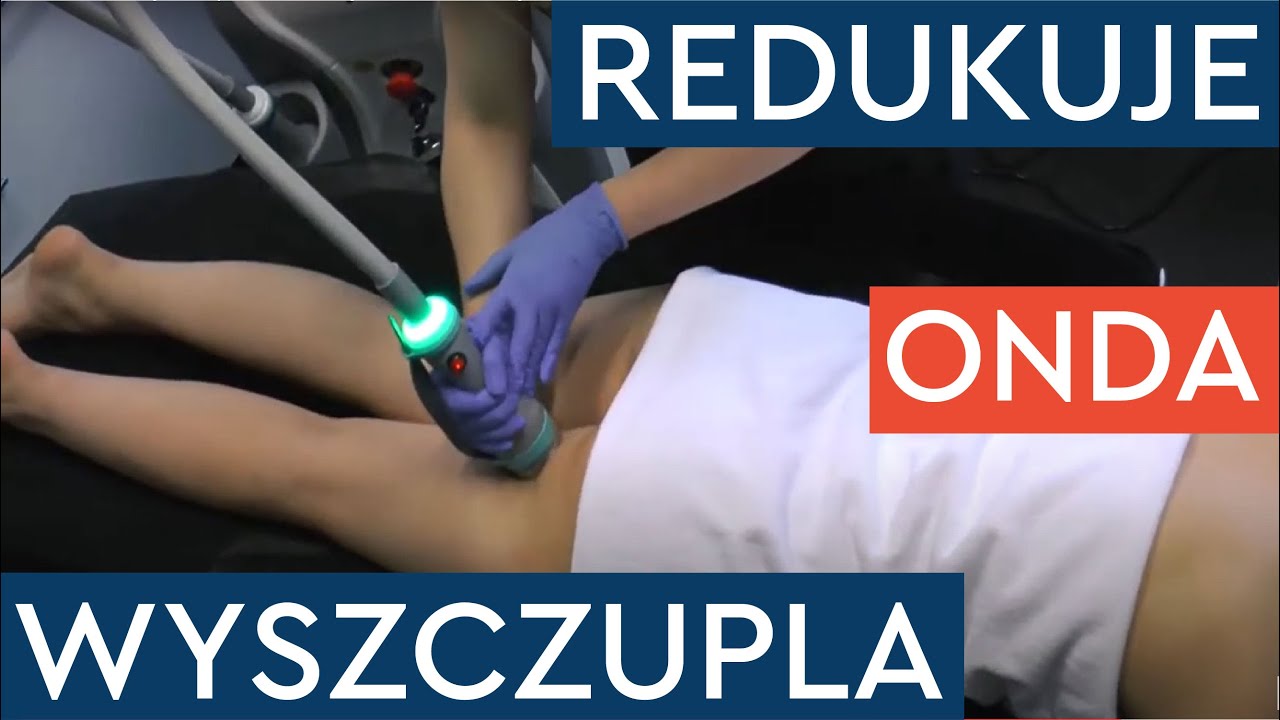 ONDA - hit w wyszczuplaniu i redukcji cellulitu. Pokazujemy, jak to działa!