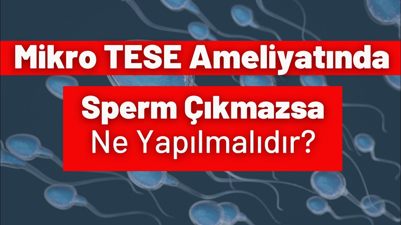 Mikro TESE Ameliyatında Sperm Çıkmazsa Ne Yapılmalıdır?