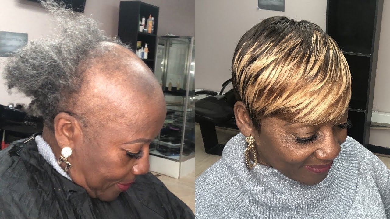 SEWING WEAVE ON SEVERE ALOPECIA (TIPS & TRICKS) | PIXIE SHORT CUT